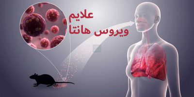 هانتاویروس چیست و چه علائمی دارد؟